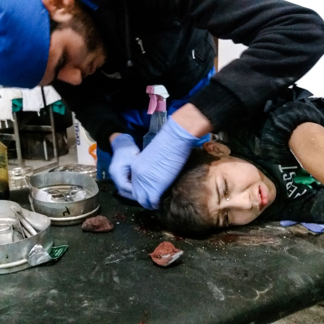 Photo by Salem Mdlala. A young boy being treated after an attack in Ghouta.